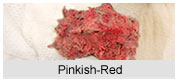 Pinkish Red Baby Poop