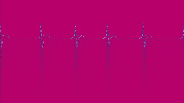 Heartbeat lines from an echocardiogram