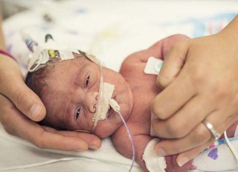 An infant receives care in the NICU.