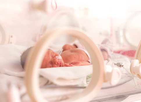 An infant baby in the critical care unit