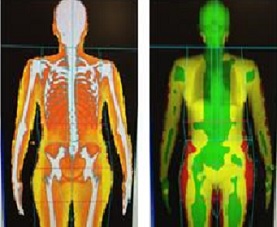 A colorful x-ray of average and obese body types