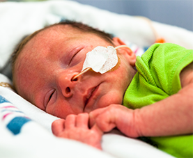 A baby is resting while in the NICU.