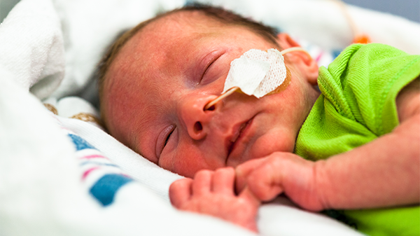 A baby is resting while in the NICU.