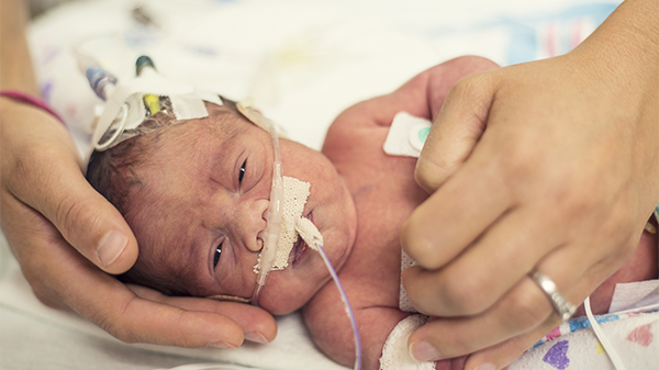 A baby is receiving care in the NICU.