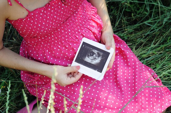 امرأة حامل تحمل صورة اولتراساوند