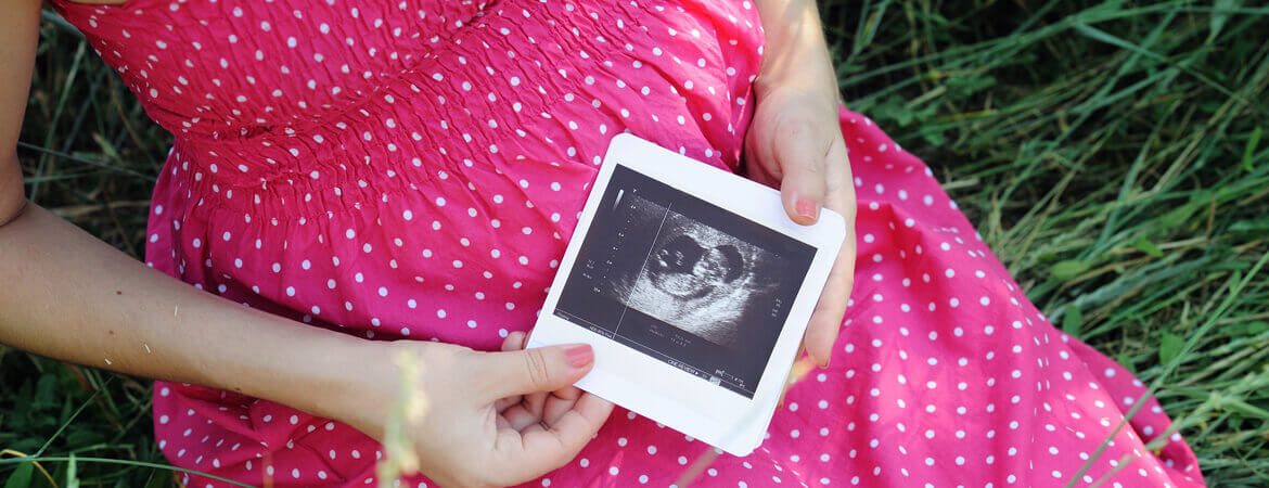 امرأة حامل تحمل صورة اولتراساوند
